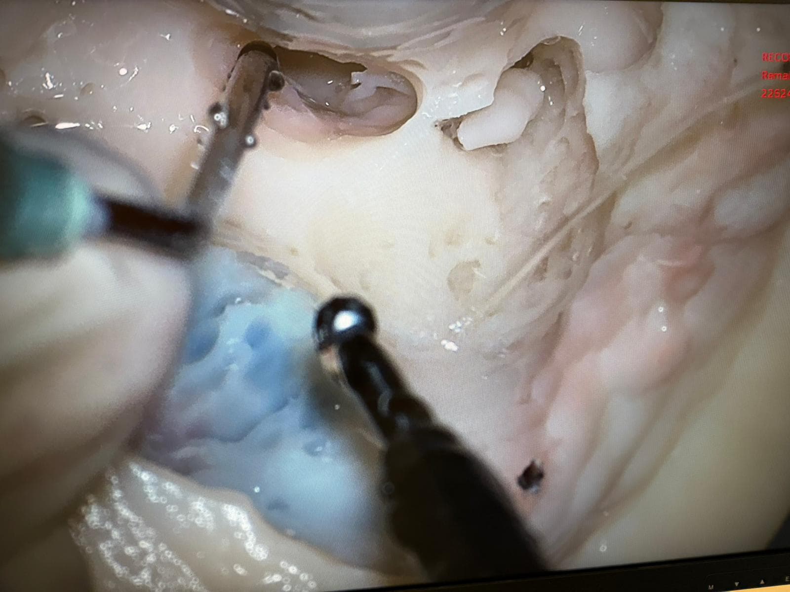 Temporal bone model, general view