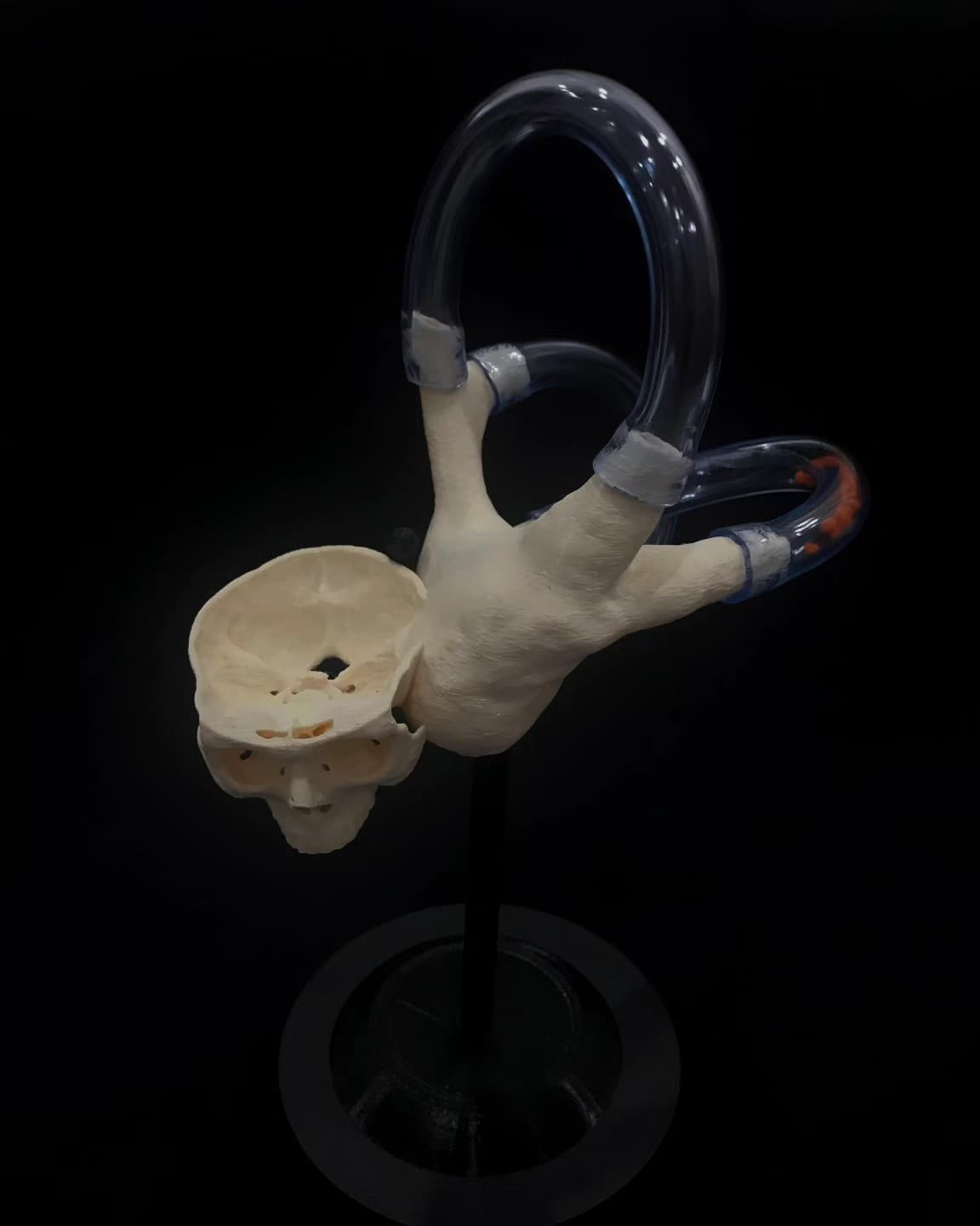 BPPV Pro 2 — Cranium Edition