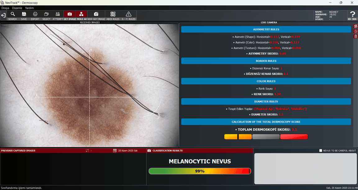 NeviTrack dermoscopy classification interface