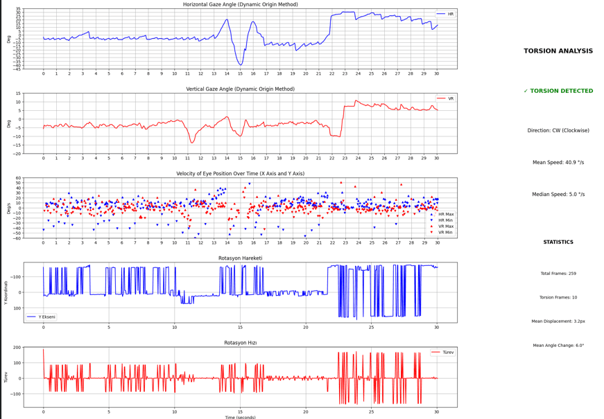 vNistagmus torsion analysis output charts