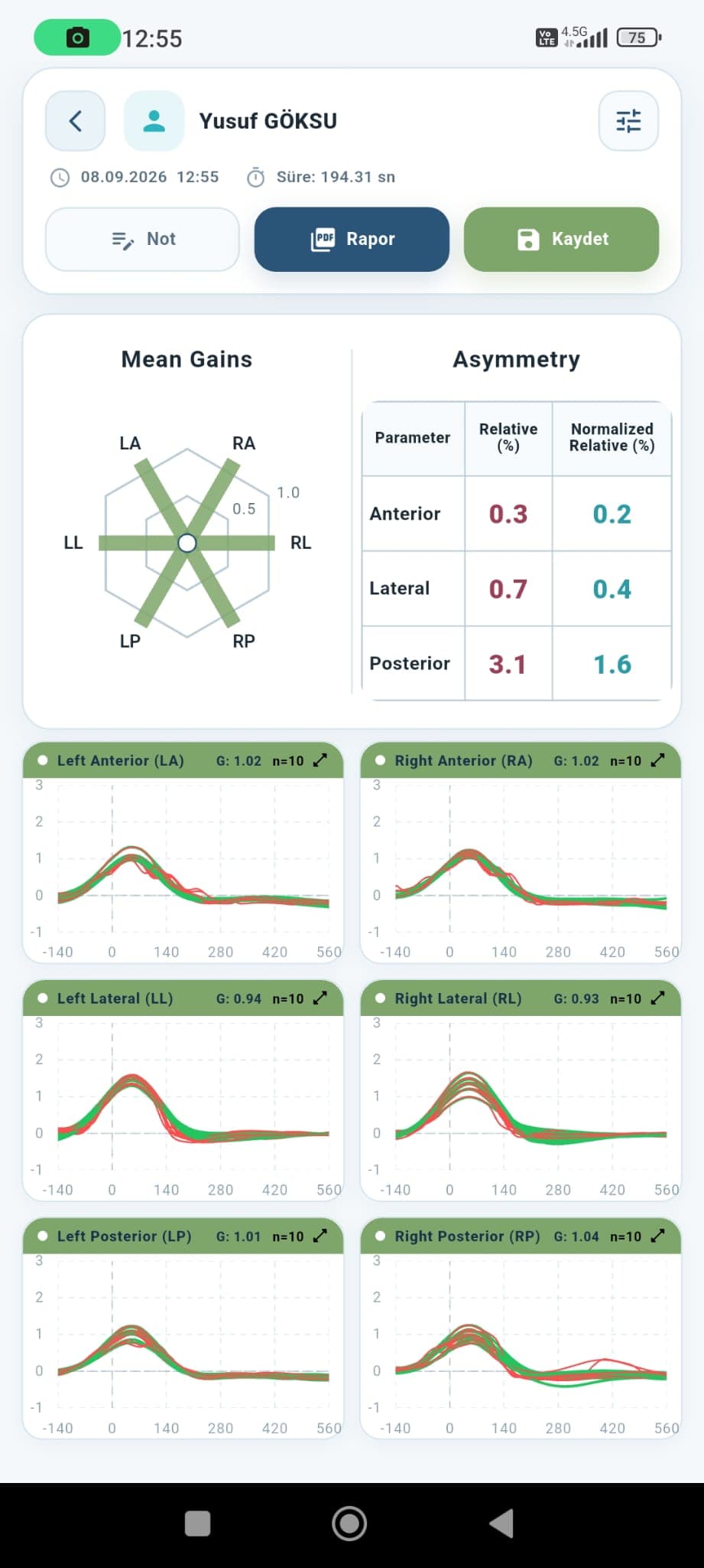 v-HIT measurement results screen